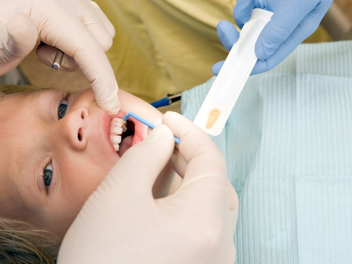 Kids Dental Services